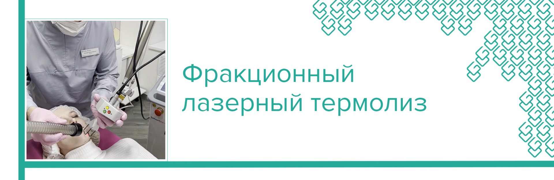 Фракционная лазерная шлифовка Deka Smart X Dot