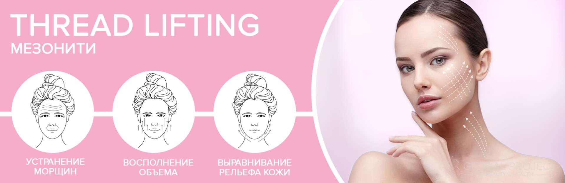 Thread lifting мезонити