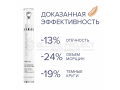 Teoxane R[II] Eyes